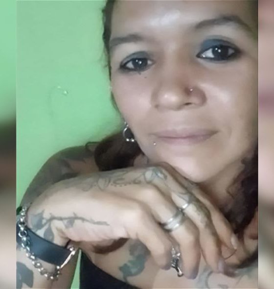 mujer quemado