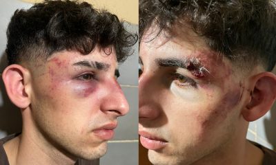 Denunció a guardias de un boliche posadeño por golpiza: "Me estaban por matar"