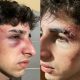 Denunció a guardias de un boliche posadeño por golpiza: "Me estaban por matar"