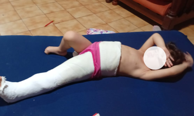 Juntan fondos para una tercera cirugía de cadera a una niña de 2 años