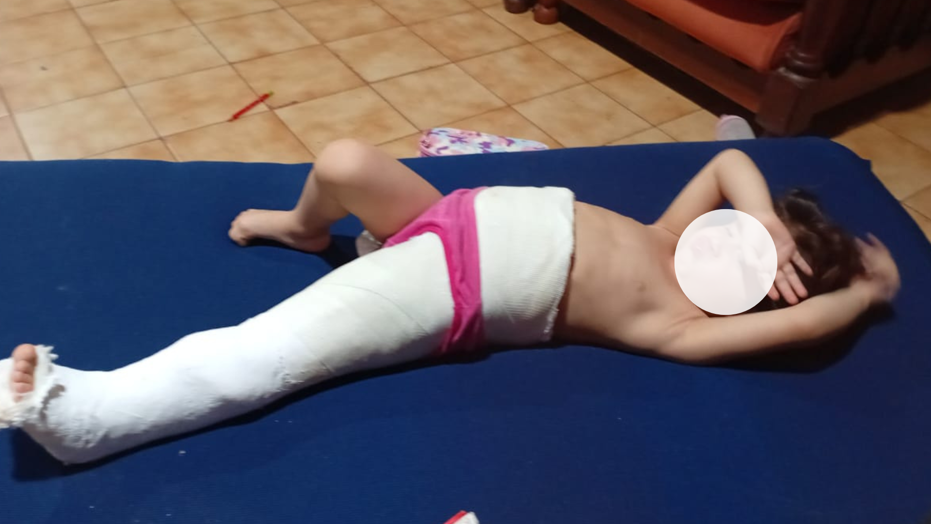 Juntan fondos para una tercera cirugía de cadera a una niña de 2 años